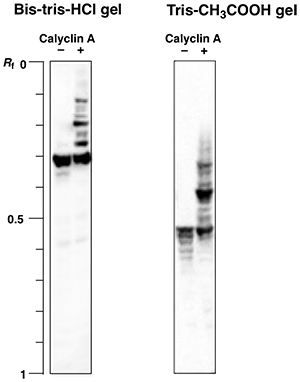 vimentin